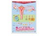 Póster Ciclo Menstrual
