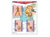 Póster Sistema Urinario